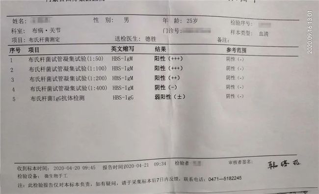 确诊阳性是什么症状呢? 确诊阳性是什么症状呢?