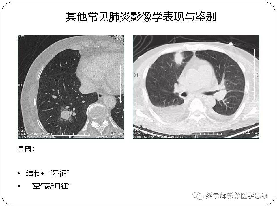 给大家讲解“微信里斗牛的房卡哪里买”获取房卡教程-哔哩哔哩 给大家讲解“微信里斗牛的房卡哪里买”获取房卡教程-哔哩哔哩
